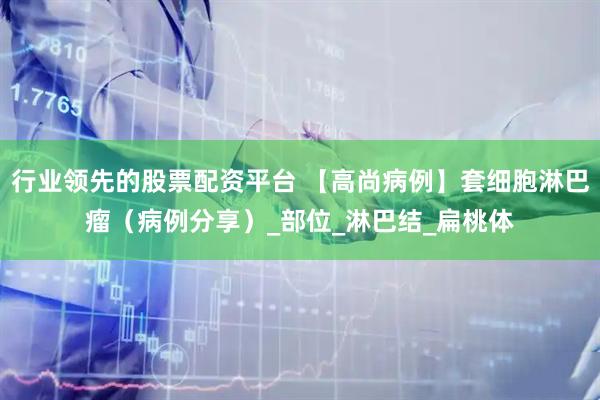 行业领先的股票配资平台 【高尚病例】套细胞淋巴瘤（病例分享）_部位_淋巴结_扁桃体